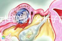 【女性調(diào)理】分析子宮壁薄的四個(gè)常見(jiàn)原因,教你三招對(duì)癥下藥可以快速改善!