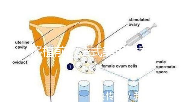 移植前做法式美甲對著床影響不少，別以為貼甲片就沒事了