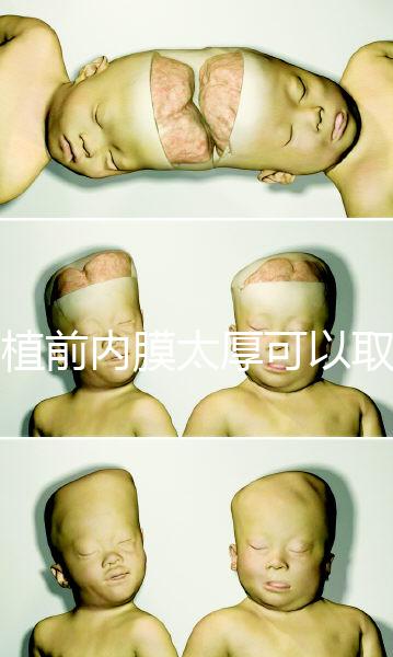 移植前內(nèi)膜太厚可以取卵早知道，疼痛因人而異