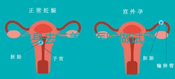 單身去三美泰醫院做試管需要花費多少錢?費用明細是怎么樣的