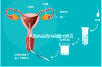 克魯宗會(huì)遺傳給后代解答嗎?他生來就有一篇清晰的文章嗎?