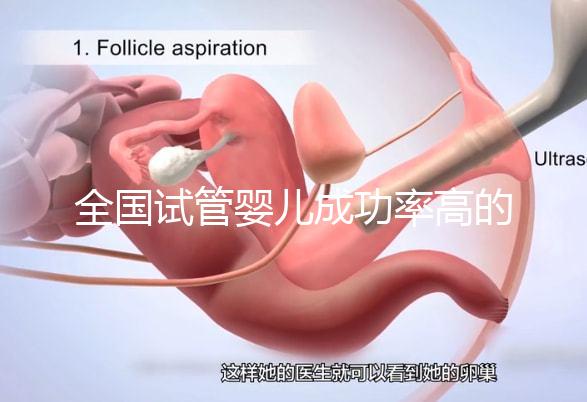 全國試管嬰兒成功率高的醫(yī)院有哪些？（全國試管嬰兒成功率高的醫(yī)院目錄一覽）
