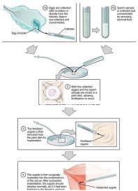 做試管嬰兒最好的醫(yī)院是哪一家？