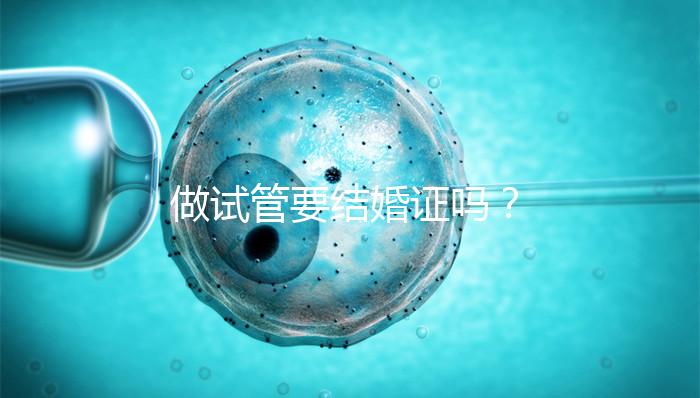 做試管要結婚證嗎？