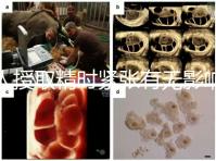 人授取精時緊張有無影響別還不造，注意事項不少不可不知