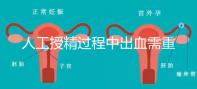 人工授精過程中出血需重視！這3種情況會影響成功率