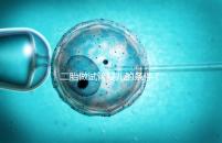 二胎做試管嬰兒的條件(試管二胎流程和費用)