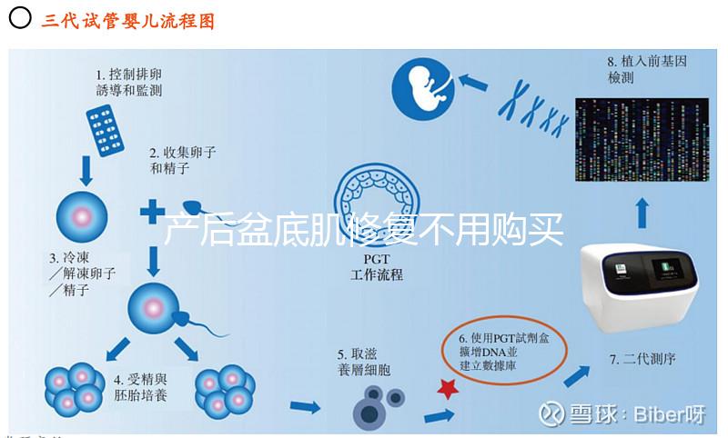 產(chǎn)后盆底肌修復不用購買儀器,這套鍛煉操照樣行