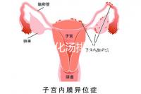 產(chǎn)后喝生化湯排惡露會使寶寶拉肚子?醫(yī)生:時間沒用對