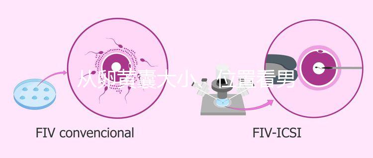 從卵黃囊大小、位置看男女，寶寶性別分辨一眼就準