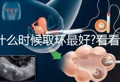 什么時候取環最好?看看各地姐妹們有什么經驗之談
