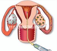 什么時候懷孕容易受孕？