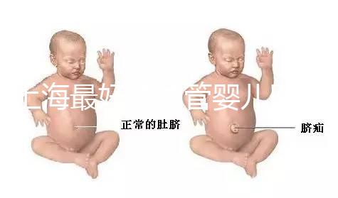 上海最好的試管嬰兒醫院信息匯總,想要最權威真得看這幾家