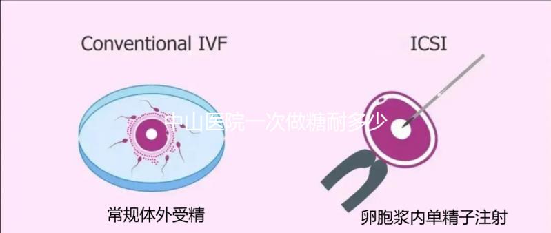 中山醫(yī)院一次做糖耐多少錢？你想預(yù)約專家嗎？