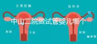 中山二院做試管嬰兒哪個醫(yī)生好?附醫(yī)院試管成功率
