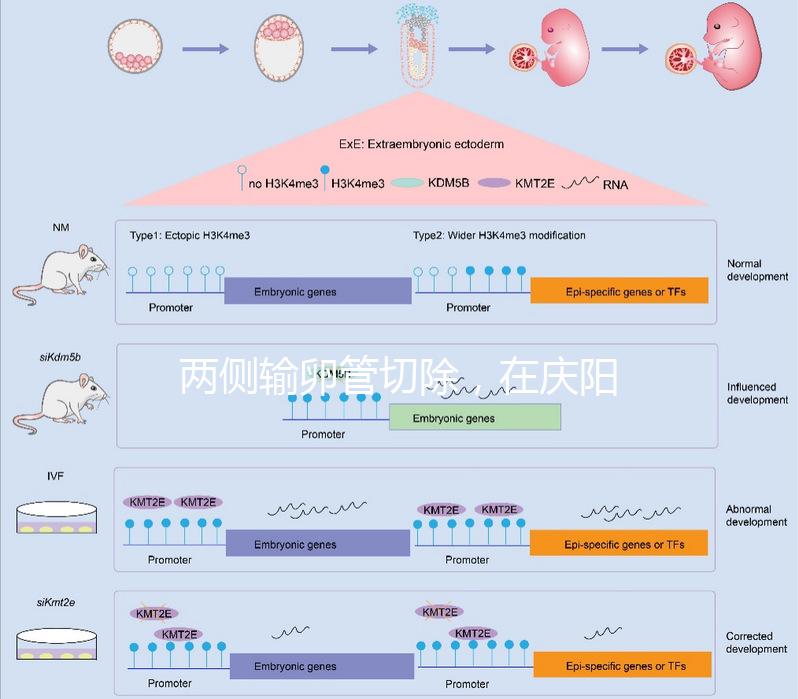 兩側輸卵管切除，在慶陽有醫院能做試管嬰兒嗎？
