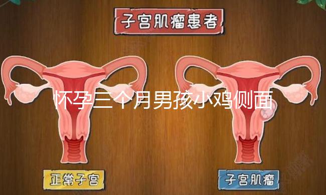 懷孕三個月男孩小雞側面二維b超圖片分享，原來兩腿間有尖