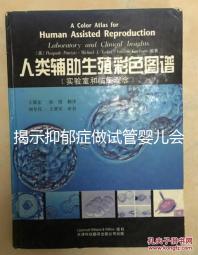揭示抑郁癥做試管嬰兒會遺傳給女兒，想避免看這個(gè)