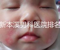 更新本溪男科醫院排名,不要錯過本溪湖區top3醫生的專業