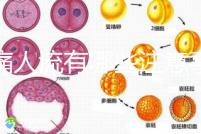無(wú)痛人流有哪些注意事項(xiàng)？