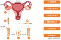 無性婚姻做試管嬰兒后來怎么樣?三個大案例揭開了內幕