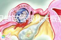 武漢做試管嬰兒大概要多少錢？