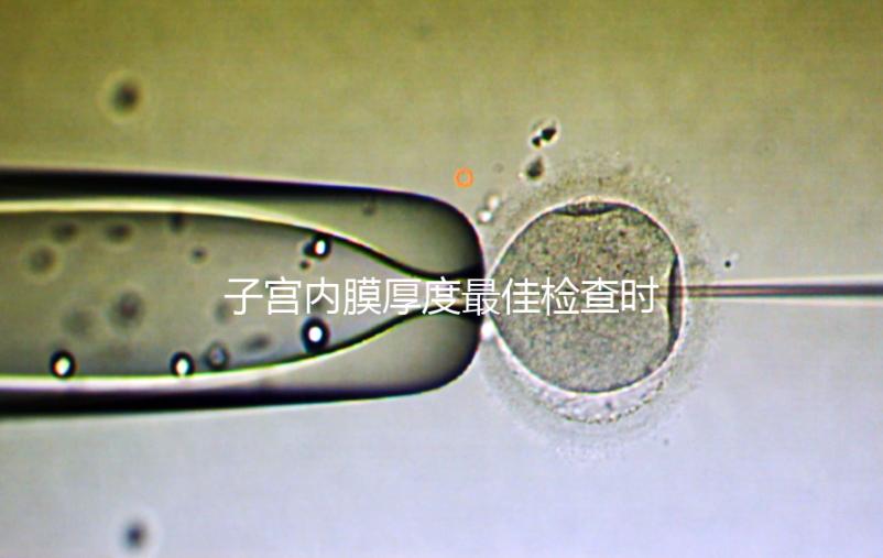 子宮內膜厚度最佳檢查時期，你有必要提前知道！