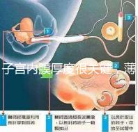 子宮內(nèi)膜厚度很關鍵,薄了厚了試管嬰兒都難成功
