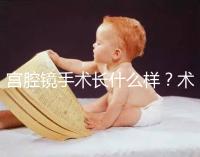 宮腔鏡手術(shù)長(zhǎng)什么樣？術(shù)后要注意什么？ ?