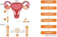 女扎后能做試管嬰兒?jiǎn)幔?5歲結(jié)扎了還能做試管嬰兒?jiǎn)幔? /></div><dfn dropzone=