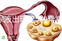 當(dāng)尿液出現(xiàn)這5種異常情況,那么腎功能檢查刻不容緩