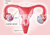 遵義哪個試管嬰兒成功率高？貴州生殖中心醫(yī)院2024年排名參考