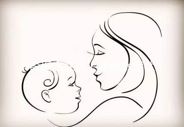 腎積水癥狀（腎積水癥狀有哪些）