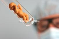 艾滋病檢測須知:酶免法3代與4代排除時間不同