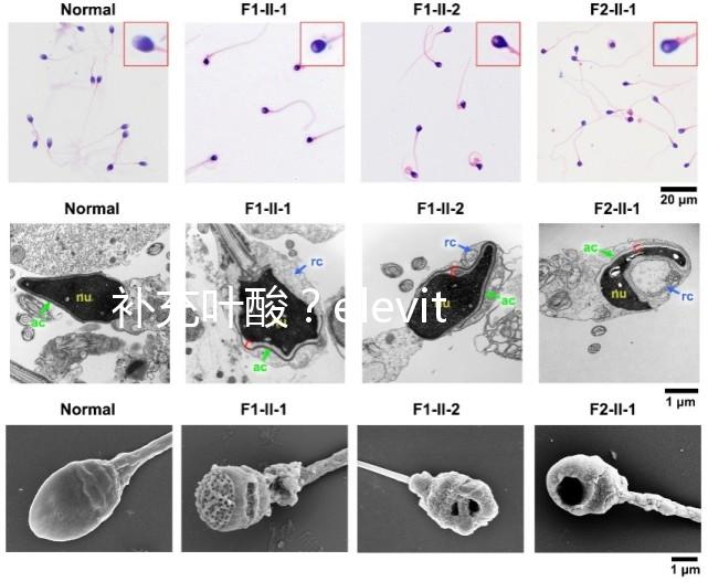 補充葉酸？elevit愛樂維那你不得不了解