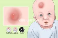 試管嬰兒現在多少錢