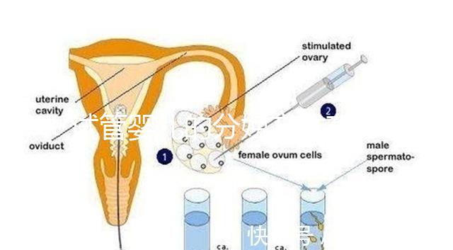 試管嬰兒的分娩方式有哪些?能否自然分娩取決于情況