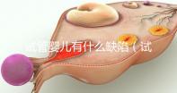 試管嬰兒有什么缺陷(試管嬰兒有什么缺陷和風(fēng)險(xiǎn))