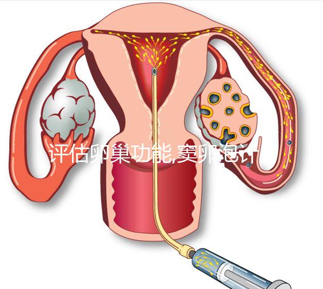 評估卵巢功能,竇卵泡計(jì)數(shù)最佳時(shí)間在月經(jīng)3
