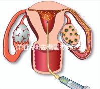 詳細說明去泰國杰特寧生殖中心做第三代試管技術的五大優勢，幫助你克服生育問題，快速隱藏！