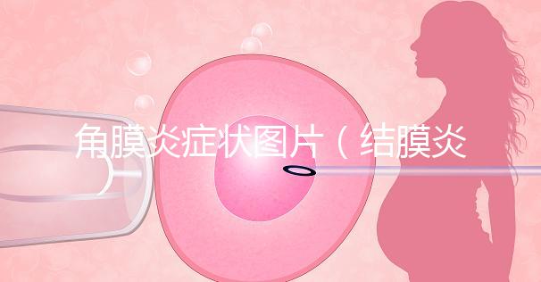 角膜炎癥狀圖片（結膜炎和角膜炎的區(qū)別）