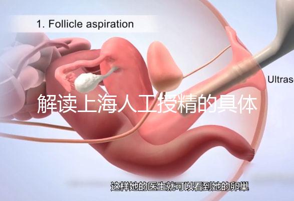 解讀上海人工授精的具體過程,會不會痛看醫(yī)生怎么說?