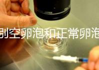 辨別空卵泡和正常卵泡是有技巧的，只需要了解這四個方面就可以輕松辨別，快速學習！