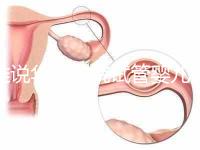 誰(shuí)說(shuō)華西二院試管嬰兒成功率不高,那是你沒選對(duì)生殖醫(yī)生