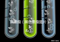 黑素瘤（黑色素瘤圖片）