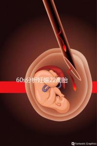 60s分析妊娠22周胎教哪些內(nèi)容比較好，觸摸、光照都有好處