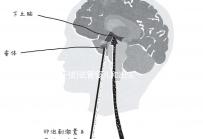 [干貨]試管嬰兒和出生缺陷