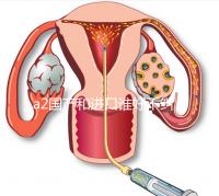 a2國(guó)產(chǎn)和進(jìn)口誰好不糾結(jié),看配方、口感、價(jià)格對(duì)比再選