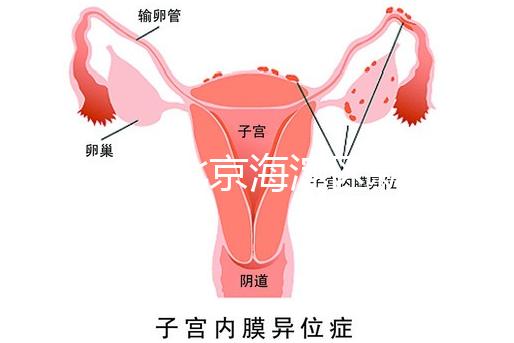 2024年北京海淀區新生兒醫療保險處理策略，照片要求不要出錯