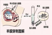 tct檢查后癥狀一覽，專家提醒做好處理措施是關鍵